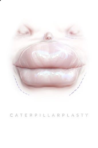 Movie poster for Caterpillarplasty